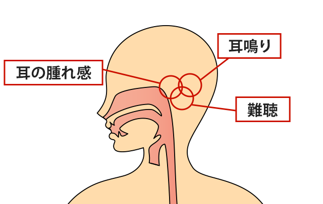 症状の該当箇所のイラスト