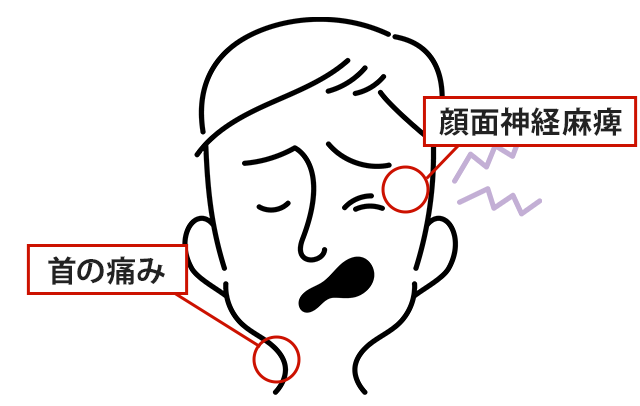 症状の該当箇所のイラスト