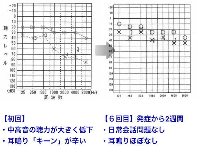 ビフォーアフター